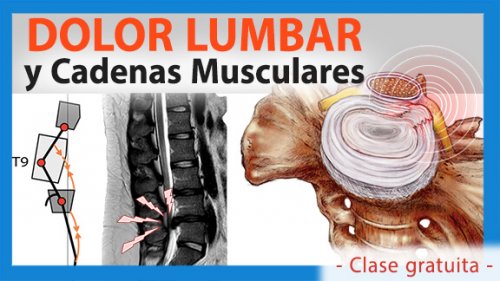 Dolor lumbar y cadenas musculares