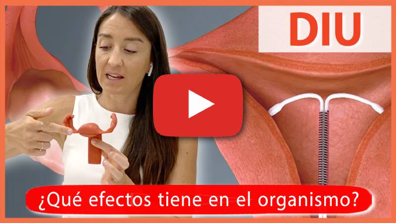 DIU, sabes cómo afecta tu suelo pélvico?